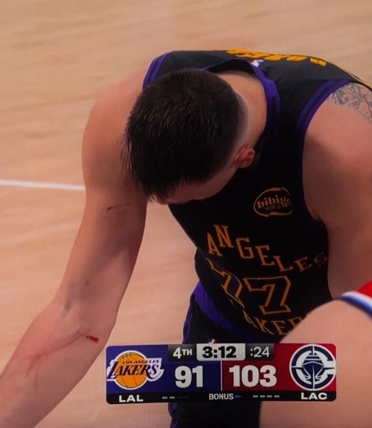 b体育官网-谁抓的~东契奇罚球时看向手臂 好几道伤口&amp;血迹斑斑